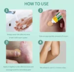 كريم أعشاب طبيعي ١٠٠٪؜ للاكزيما وحساسية الجلد 20مل - Image 2