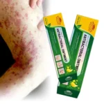 كريم أعشاب طبيعي ١٠٠٪؜ للاكزيما وحساسية الجلد 20مل