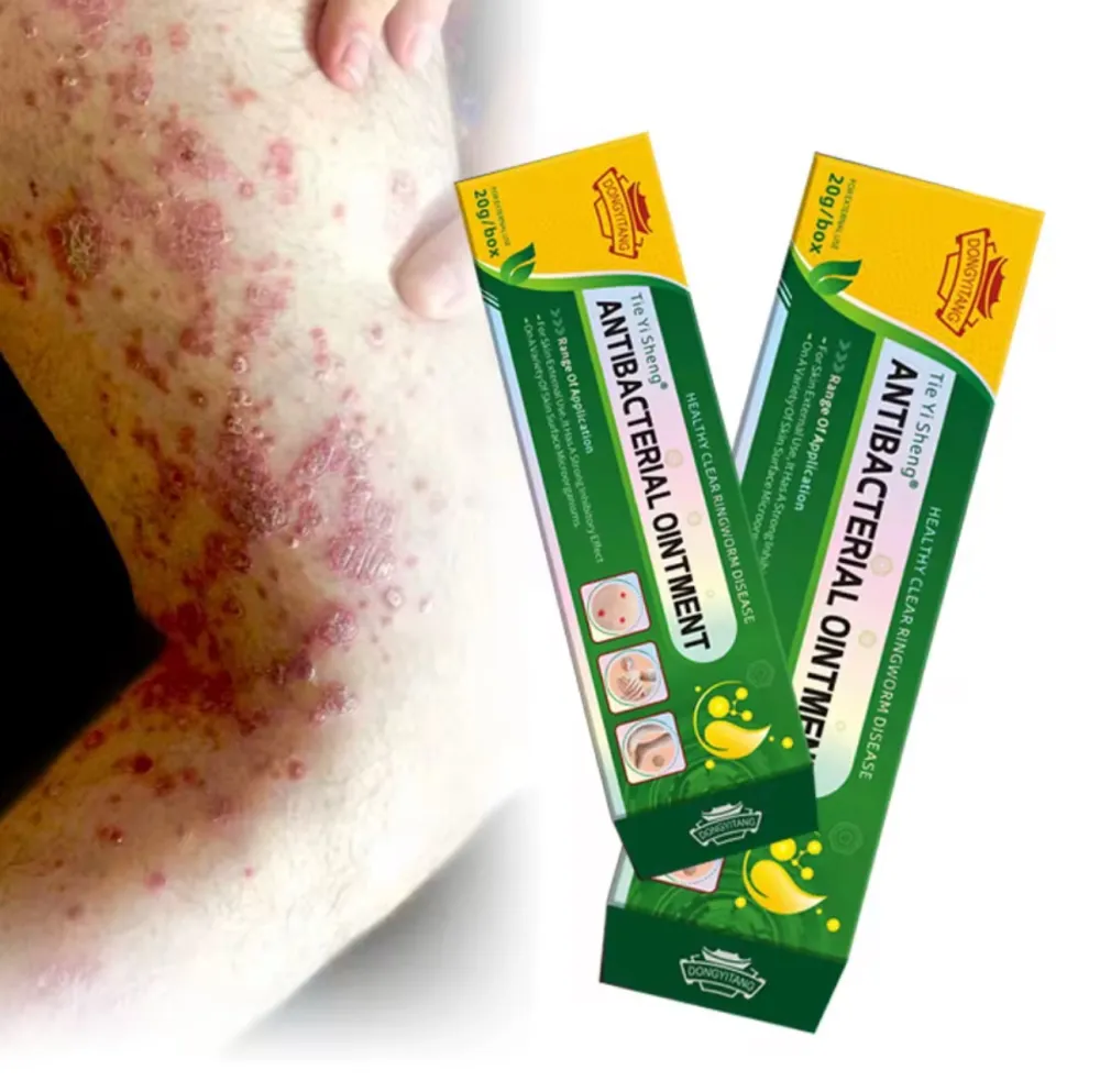 img_0241 كريم أعشاب طبيعي ١٠٠٪ للاكزيما وحساسية الجلد 20مل - Image 1