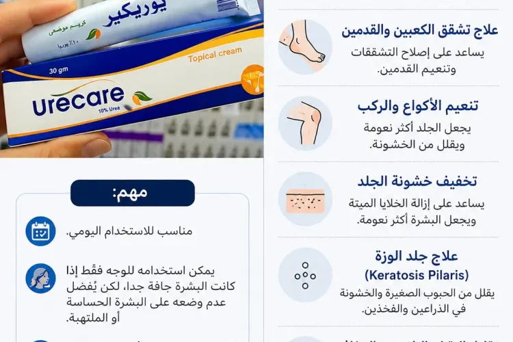 يو ريكير